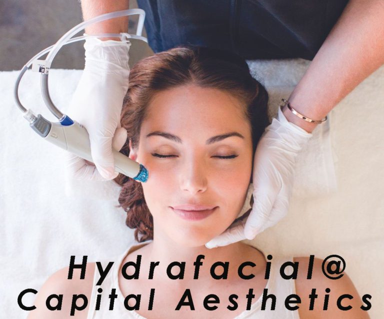 Hydrafacial Ottawa Near Kanata Capital Aesthetics